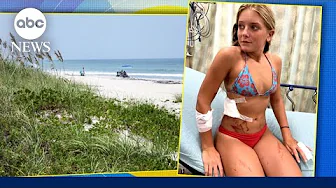 13-year-old fights off shark at beach | GMA